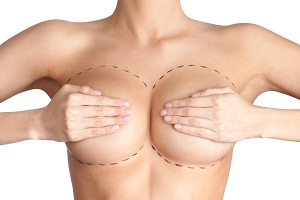 ¿Qué son las mamas tubulares?