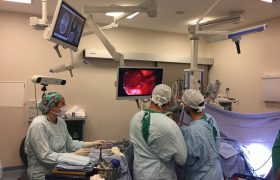 Cirugía endoscópica transnasal, avances en tumores cerebrales - Grupo Gamma