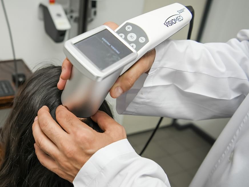 Tricoscopía: Novedad en el diagnóstico de patología del pelo y cuero cabelludo
